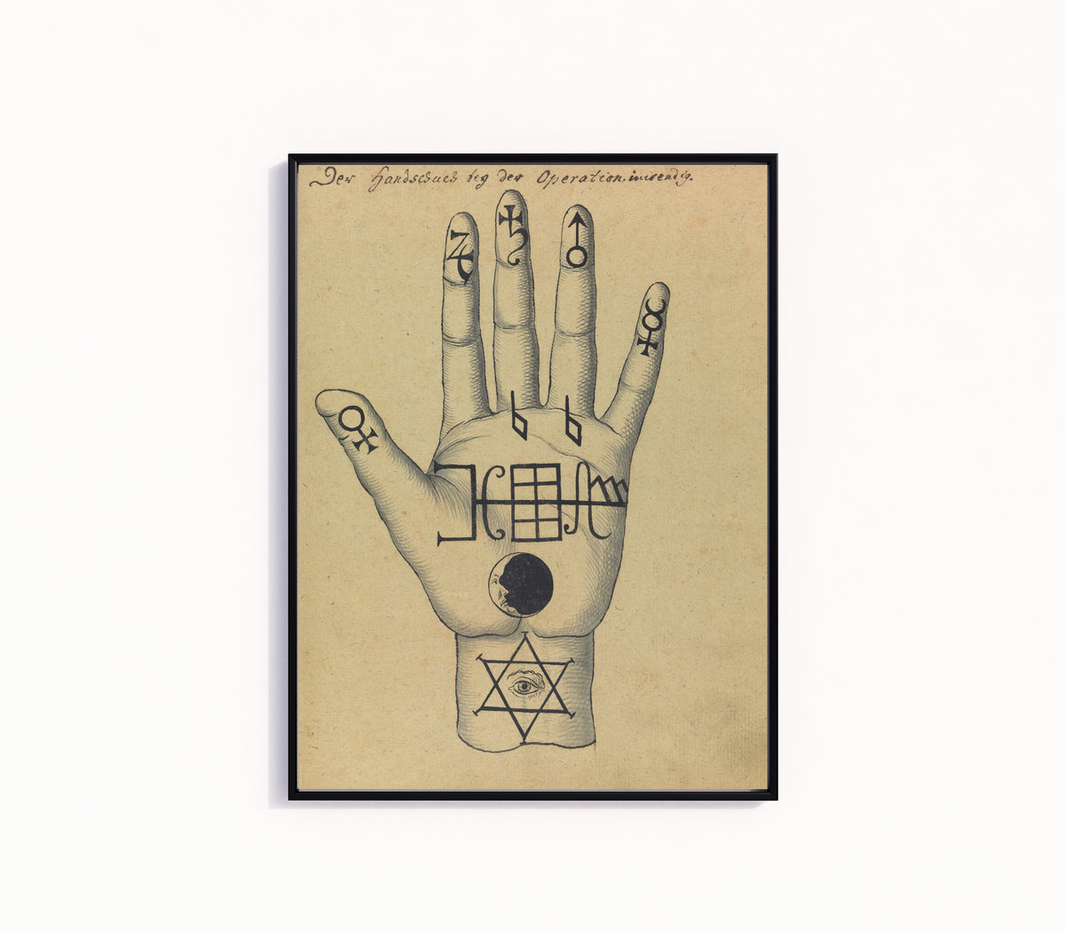 Framed art print of Der Handschuch bey der Operation inwendig by Unknown artist, in a slim black frame on a plain white wall