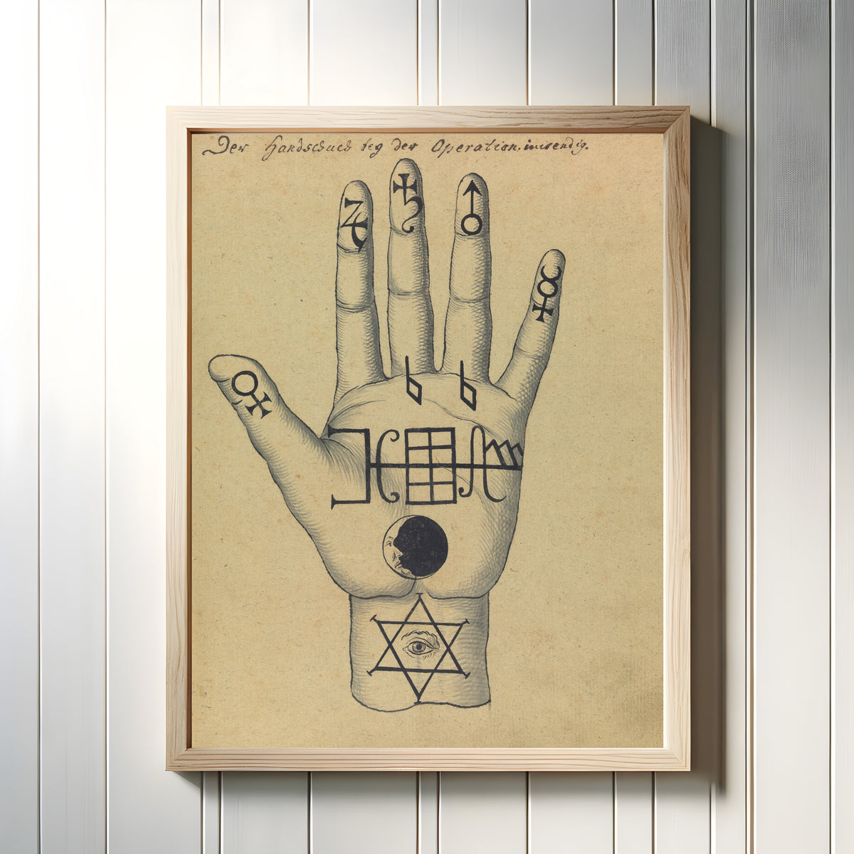 Framed art print of Der Handschuch bey der Operation inwendig by Unknown artist, in a light wood frame on a white panelled wall